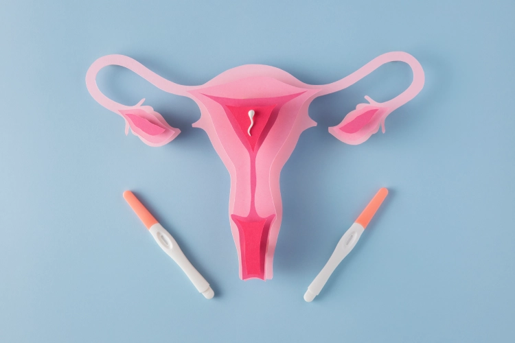 Ovarian Cysts Photo 2